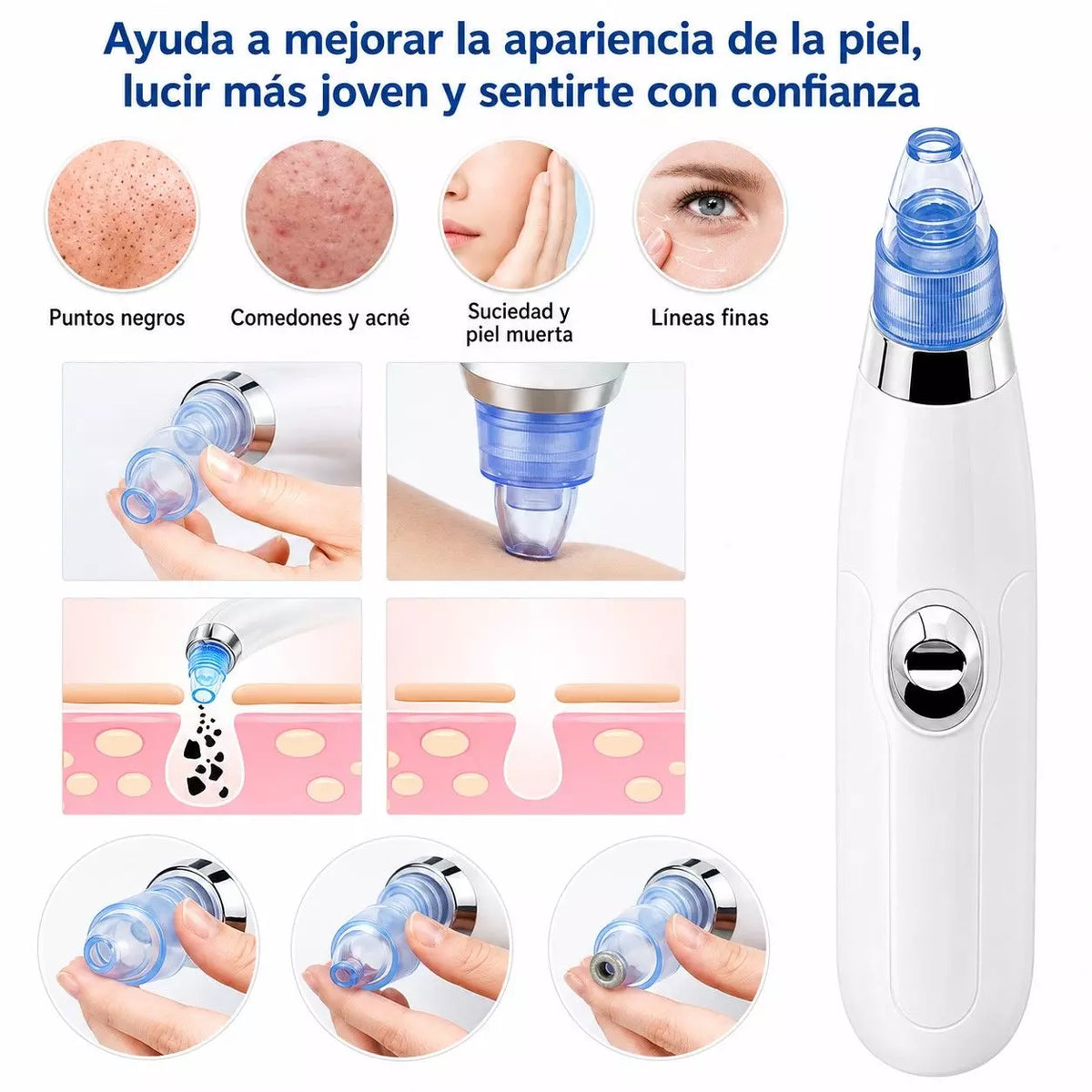 Extractor de Puntos Negros Turbo
